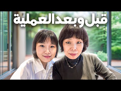شوفوا الفرق بعد عملية شد الوجه والجفن السفلي! 😱 تحول خالتي لا يُصدق!
