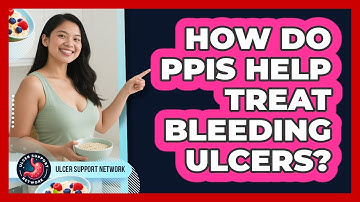 How Do PPIs Help Treat Bleeding Ulcers? - Ulcer Support Network