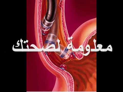 الحل المثالي لدوالي المرئ ح ٣١ لبرنامج معلومةلصحتك بإذاعةالبرنامج العام مع د محمدعبدالوهاب الأبجيجي