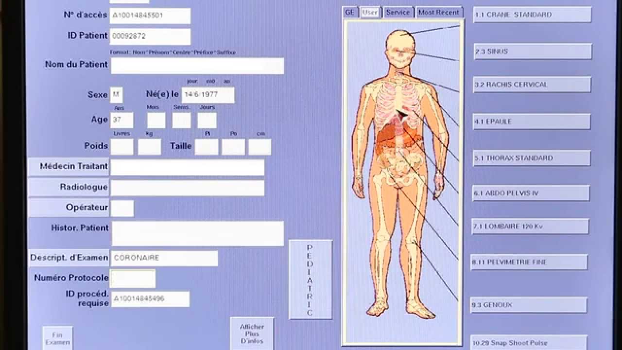 Acquisition Coroscanner BASSES DOSES Tutoriel YouTube Acquisition Coroscanner BASSES DOSES Tutoriel YouTube