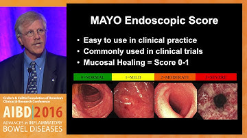 How can we best determine endoscopic severity in ulcerative colitis and Crohn