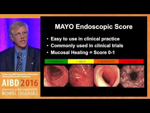 How can we best determine endoscopic severity in ulcerative colitis and Crohn&rsquo;s disease?