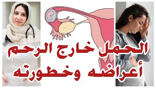 أعراض الحمل خارج الرحم