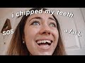 hi, i chipped my teeth. *COLLEGE STORY TIME*