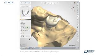 Atlantis™ abutments− Atlantis abutment Core File | Dentsply Sirona