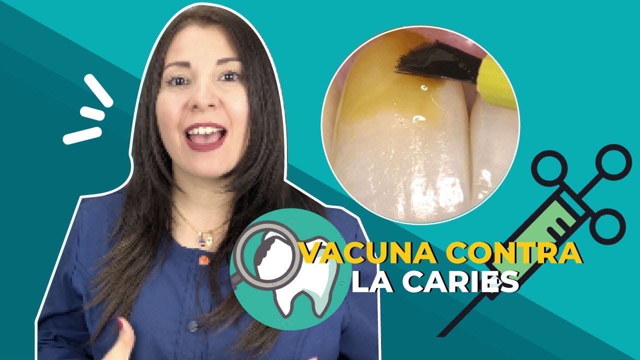¿Qué es el BARNIZ FLUORADO y para qué sirve  La vacuna contra la caries   Dra Joana Campolargo