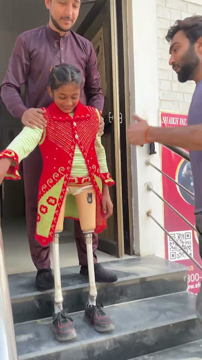 Leg walk exercises/legless person/sach foot /kaki palsu/ #hassanzarar #prosthetics #artificiallimbs
