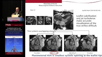MRI (Dipan Shah, MD)