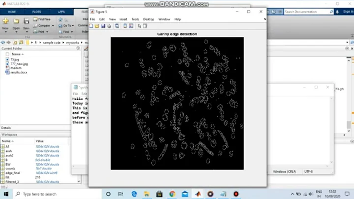 Canny edge detection in Matlab code to detect edges | Edge detection matlab