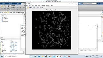 Canny edge detection in Matlab code to detect edges | Edge detection matlab