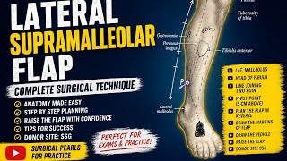 Lateral Supramalleolar Flap | Anatomy, Surgical Markings | Plastic Surgery