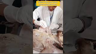Dissection of Thorax#ThoraxDissection#AnatomyShorts#MedicalShorts#HumanAnatomy#ThoraxAnatomy#bhms#yt