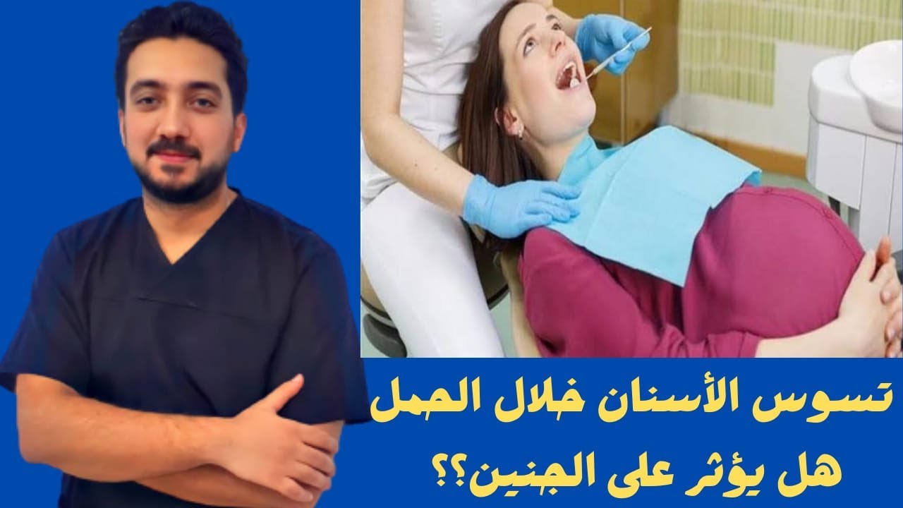 تسوس الأسنان خلال الحمل -هل يؤثر على الجنين؟