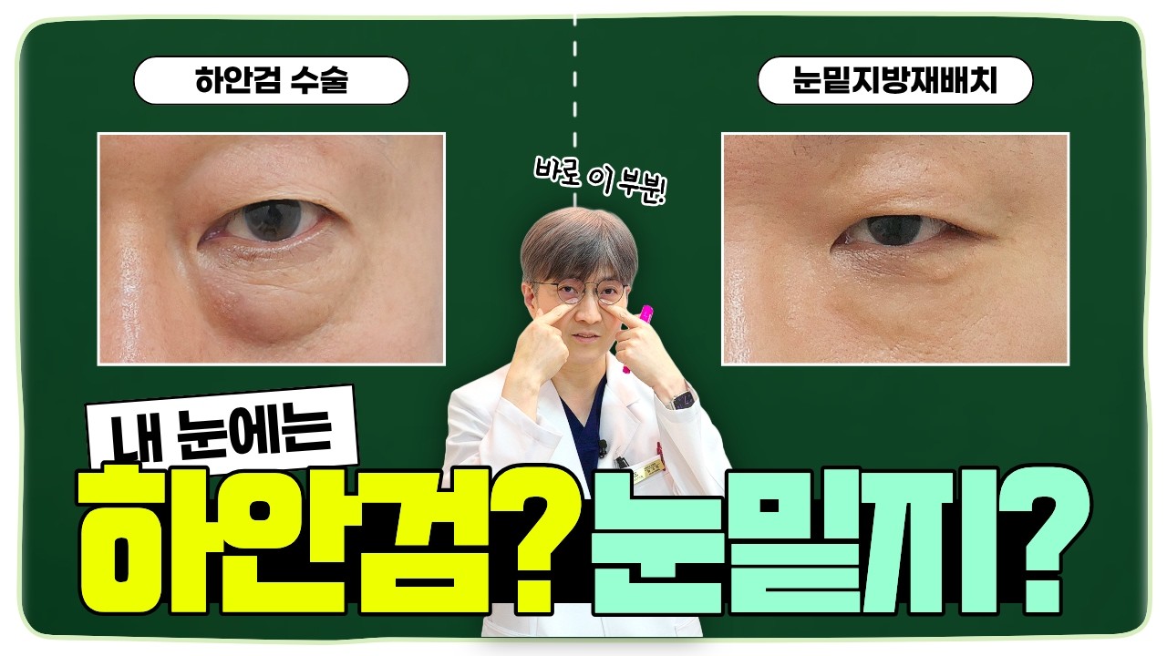 [중년 눈 노화 - 눈밑] 나에게 맞는 눈밑 수술 찾는 법! 이것만 알고 가세요~! (feat. 하기영 원장)