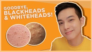 BEST SKINCARE for BLACKHEADS & WHITEHEADS! (OPEN & CLOSED COMEDONES) | Jan Angelo