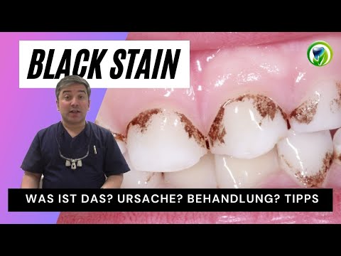 #BlackStain - Was ist das? Ursache? Gefährlich? Behandlung? Tipps