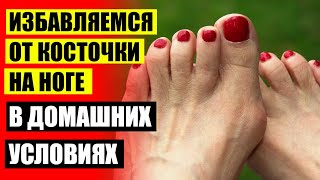 🤒 РАСТЕТ КОСТОЧКА НА БОЛЬШОМ ПАЛЬЦЕ ☑ ДЕФОРМАЦИЯ СТОПЫ НОГ ПАЛЬЦЫ