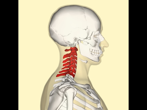 Video: Cervikálna Osteochondróza - Príznaky, Liečba, Cvičenie, Gymnastika A Masáže. Ako Liečiť Osteochondrózu Krčnej Chrbtice?