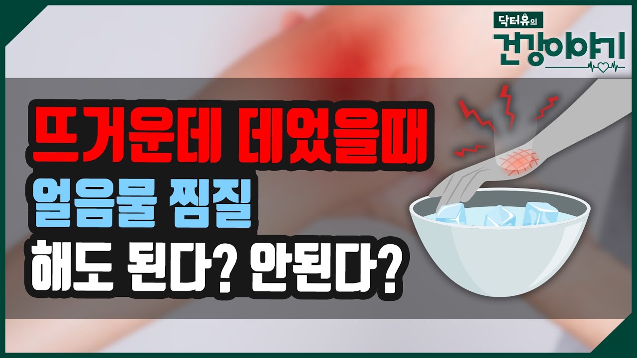 화상 입었을때 얼음물 찜질 해도 된다? 안된다? [닥터유의 건강이야기] - YouTube