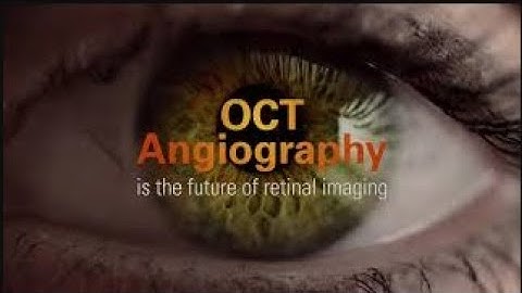 OCT Angiography (OCTA) by Optovue