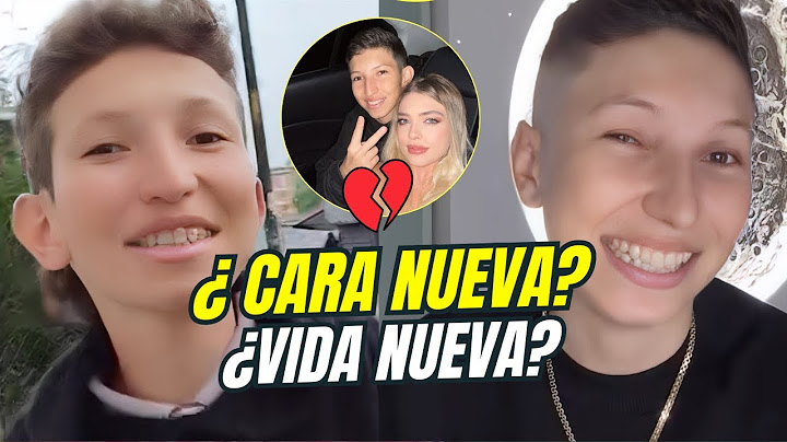 Cris Valencia se operó el rostro… ¡y terminó con la rusa Yana Karpova!