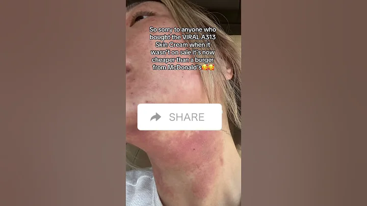 Skincare game changer: retinol for radiant skin