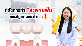 หลังการทำ สะพานฟัน ควรปฏิบัติตัวยังไงบ้าง!!