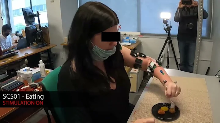 Eating – Spinal Cord Stimulation Instantly Improves Arm Mobility After Stroke