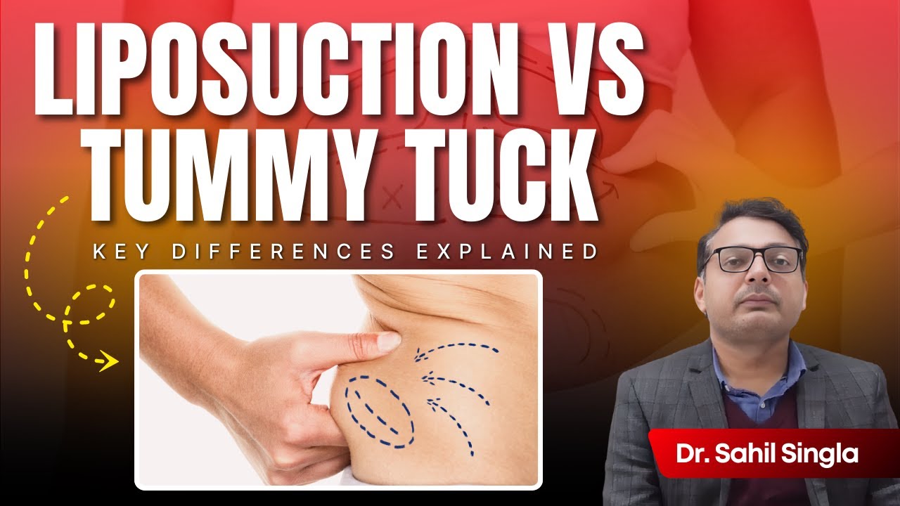 Confused between liposuction and a tummy tuck? Here’s the simple truth ✨