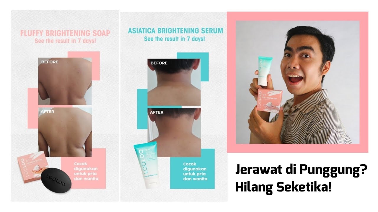 Cara Menghilangkan Jerawat di Punggung | Review LooLoo: The Skin