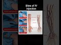 #nursingexam2025#sites_of #IVinjection#cgvyapam #intravenousinjection#veins#yt #ytshorts#nursing#ssc