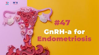Gnrh-A For Endometriosis