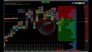 Rook Footprint Orderflow - LIVE TRADE 3 USING ORDERFLOW