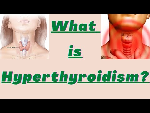 Hyperthyroidism and its causes, risk factors, diagnosis, management in Nepali.