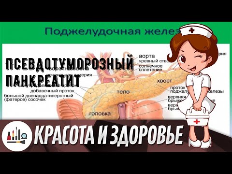 Псевдотуморозный панкреатит