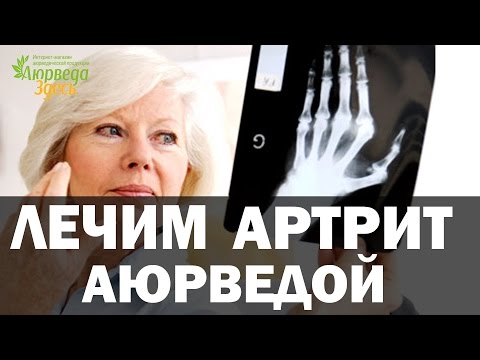 Лечение Артрита аюрведой. Артрит аюрведа. Аюрведа Здесь