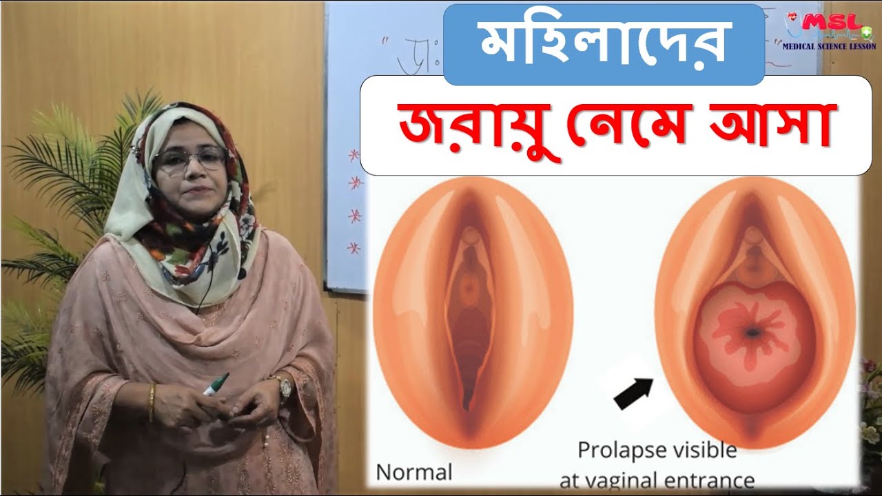 Alena jinsiy porno Jinsiy Osiyo selkie