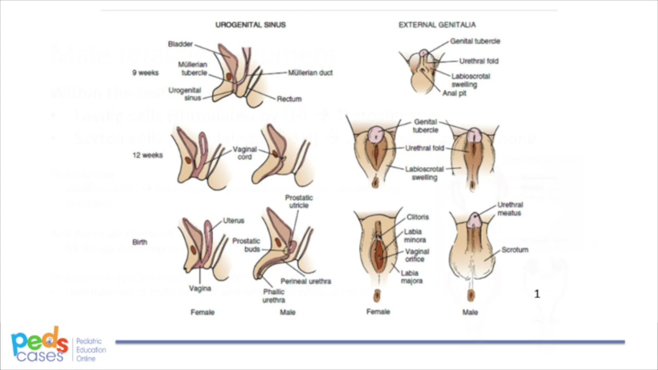 Ambiguous Genitalia Diagram