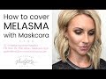 Covering Melasma w/ Maskcara Makeup