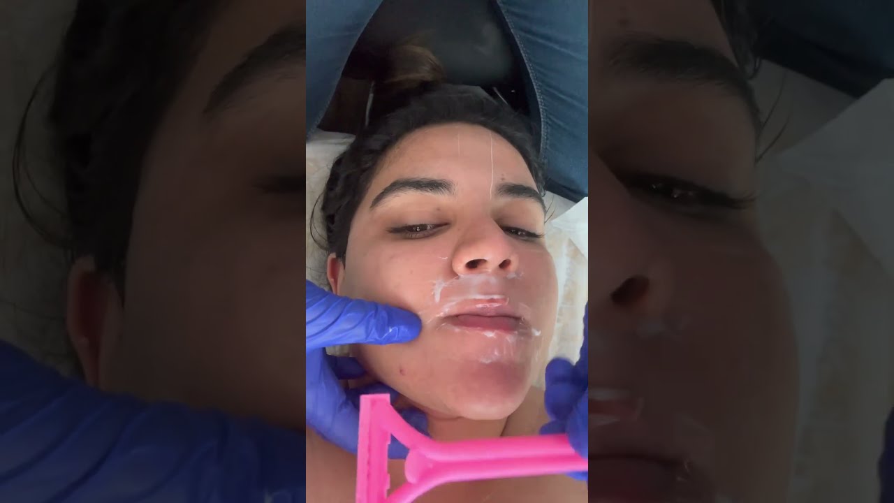 I Did Laser Hair Removal AT Home Ashortaday