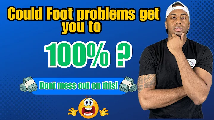 Unlock VA Benefits: Top 9 Foot Conditions You Can Claim