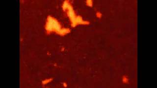 Download Lagu Membrane patches MP3