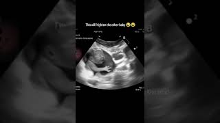 Funny AI Twin Pregnancy on Ultrasound