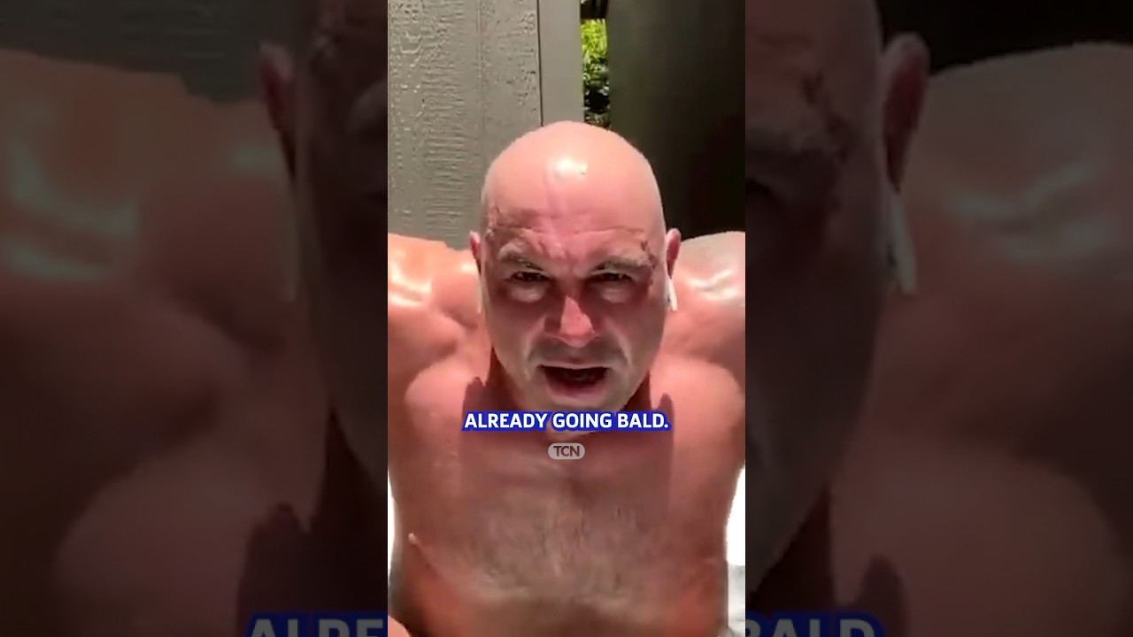 Should You Go Bald if You&rsquo;re Losing Hair?