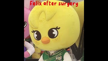 Felix before and after plastic surgery #straykids #skz #felix #yongbok #skzfelix #fypシ #fyp #kpop