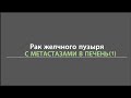 Историяпациента с раком желчного пузыря и метастазами в печени (часть#1)