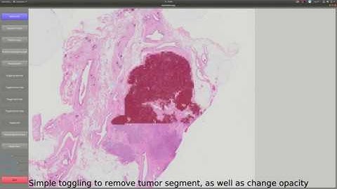 Demo of FastPathology: An open-source platform for artificial intelligence-based digital pathology
