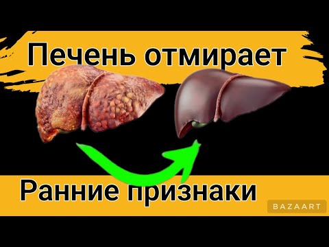 9 признаков того,что Ваша ПЕЧЕНЬ ОТМИРАЕТ! 90 даже не Догадываются..