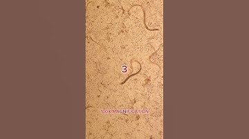 Vodka vs Parasites under the microscope