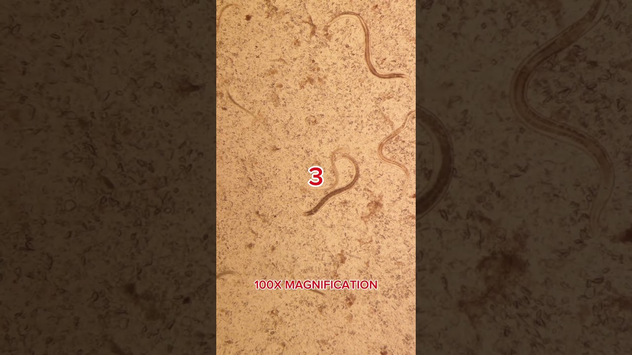 Vodka vs Parasites under the microscope